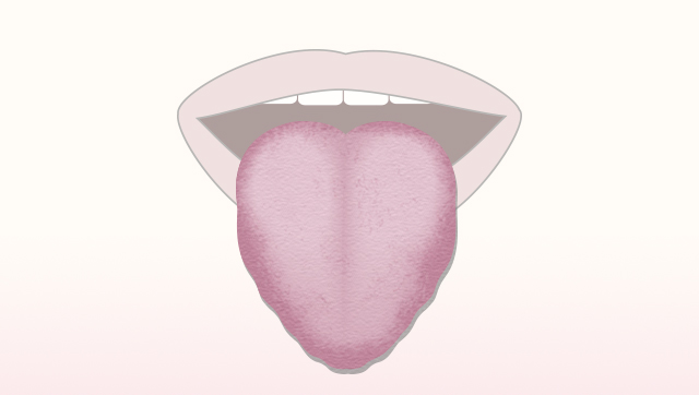 舌の周りがギザギザしている舌の説明イラスト