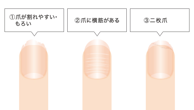 い 貧血 頭痛 失神とは―初めて意識を消失してしまった場合は要注意！