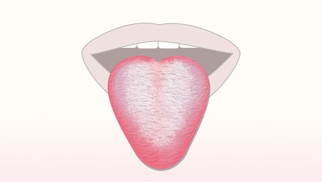 舌の特徴
