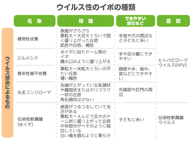 ウイルス性のイボの種類の分類表