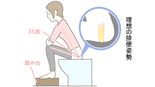 腸のデザインを考えた便座への座り方のイメージイラスト