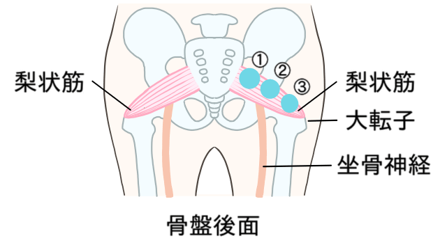 テニスボールを使う自重マッサージ 梨状筋の位置【イラスト】