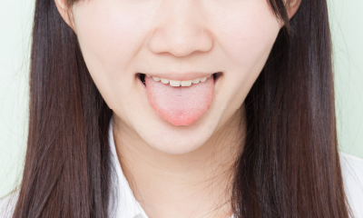 舌診 イメージ