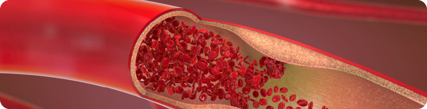 血管のはなしイメージ