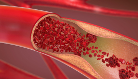 血管イメージ