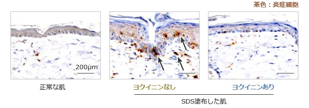 表皮への炎症細胞の浸潤を抑えた イメージ