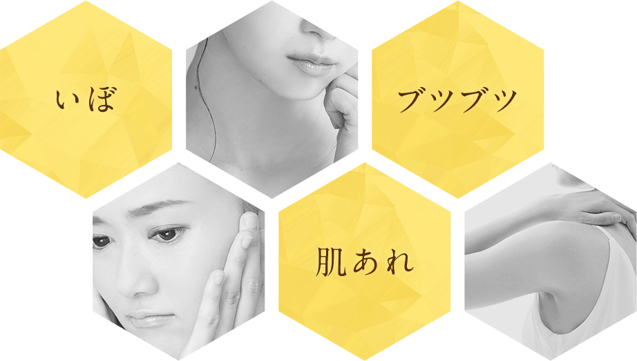 いぼ　肌あれ　ブツブツ